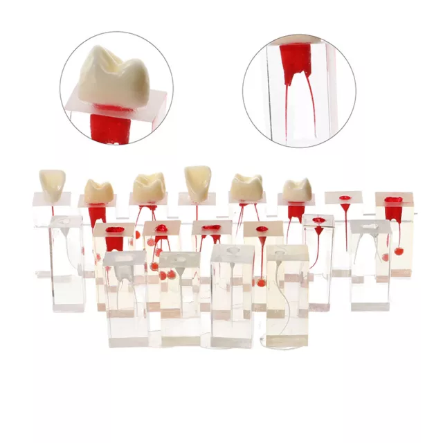 Dental Endodontic Root Canal Model For Student Studying Training Teaching Demo