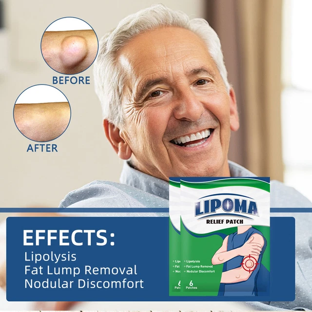 30 SHEET LIPOMA Removal Patch Herbal Organic Lipolysis Fat Lump Relief