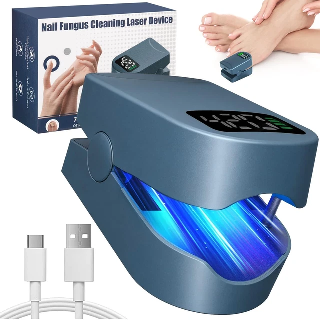 Laser Ongle Mycose Avis