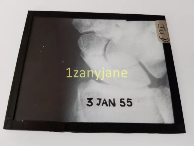 IUD HISTORIC Magic Lantern GLASS Slide 3 JAN 55