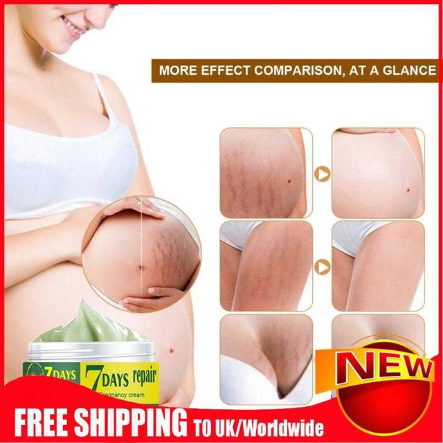Crema corpo anti-angolo donna incinta rimozione smagliature cura della pelle