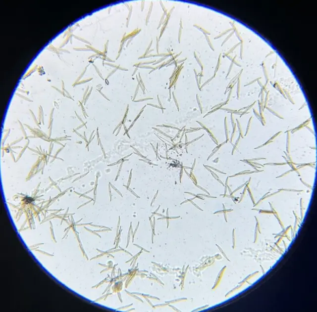 19th c J.D. Moller Microscope Diatom Test Slide Pleurosigma Spencerii Sm.
