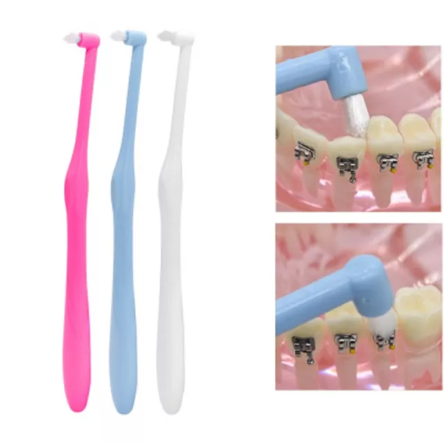 Teeth Braces Orthodontic Braces Toothbrush Wisdom Tooth brush Interdental brush