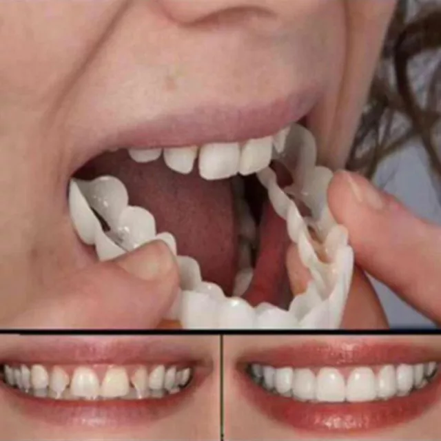 Kosmetische Zahnmedizin Prothese Zahnersatz für Falsche Zähne Instant Kosmetik