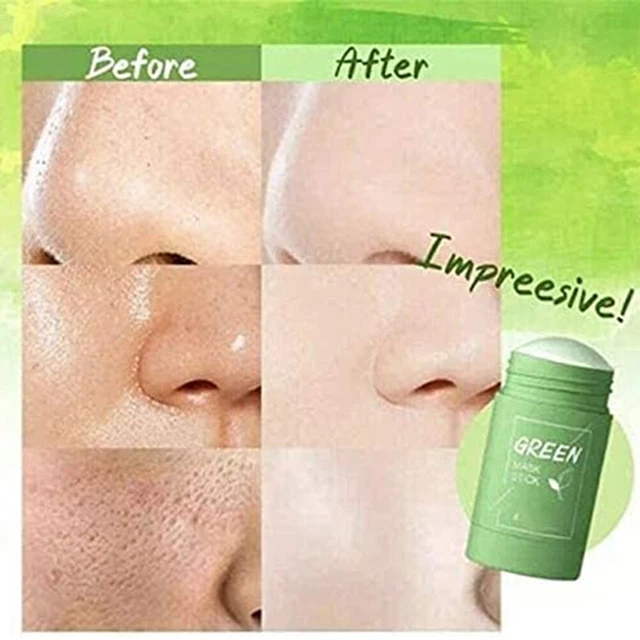 Maschera controllo olio maschera controllo olio pulizia profonda umidità XAT
