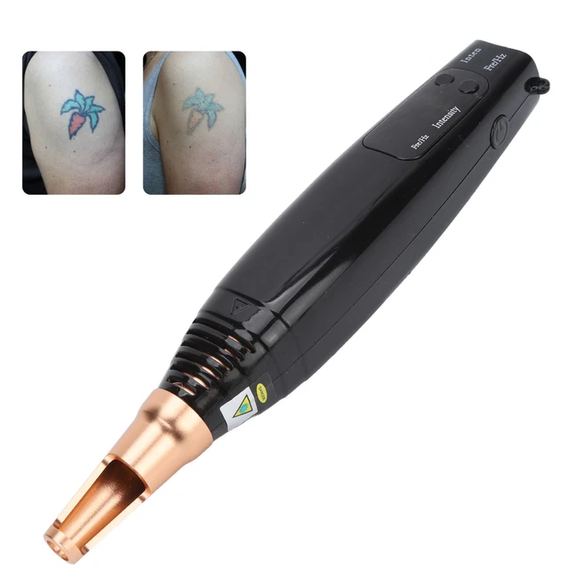 (UK Plug) Picosecond Pen Blaues Licht Tattoo Freckle Mole Warze Entfernung SGH
