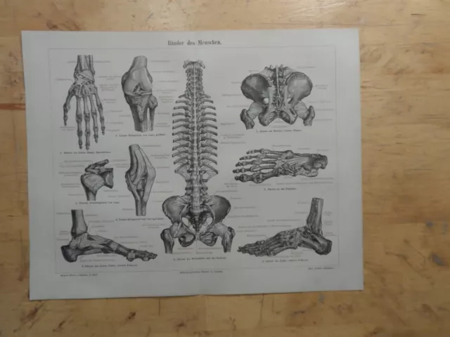 Orig.(1890) Lithographie Bänder des Menschen