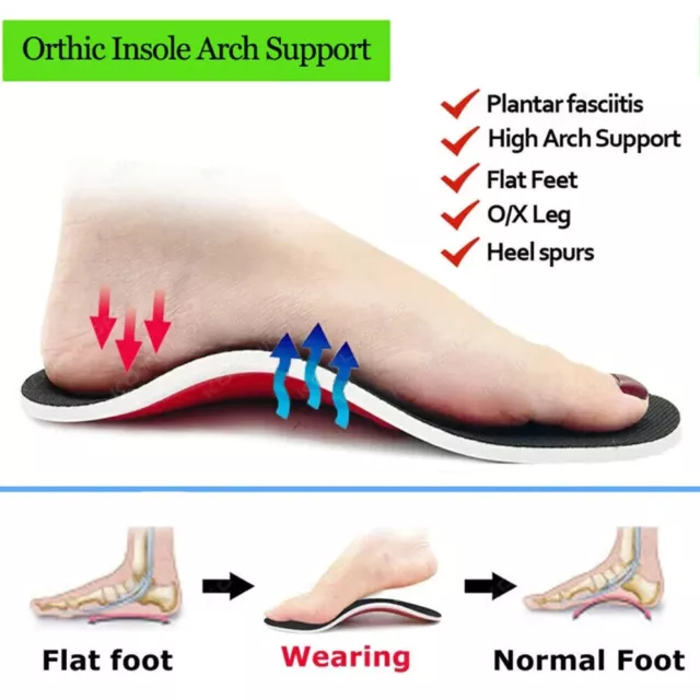 Arch Support Shoe Insoles Pain Relief Plantar Fasciitis Orthotic Shoe Inserts 3