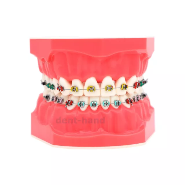 Dental Typodont Orthodontic 1:1 Teeth Model with Metal Brackets Braces M7010-2