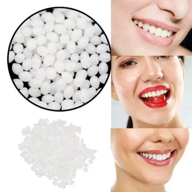Tooth Repair Kit - Moldable False Teeth, Temporary Tooth