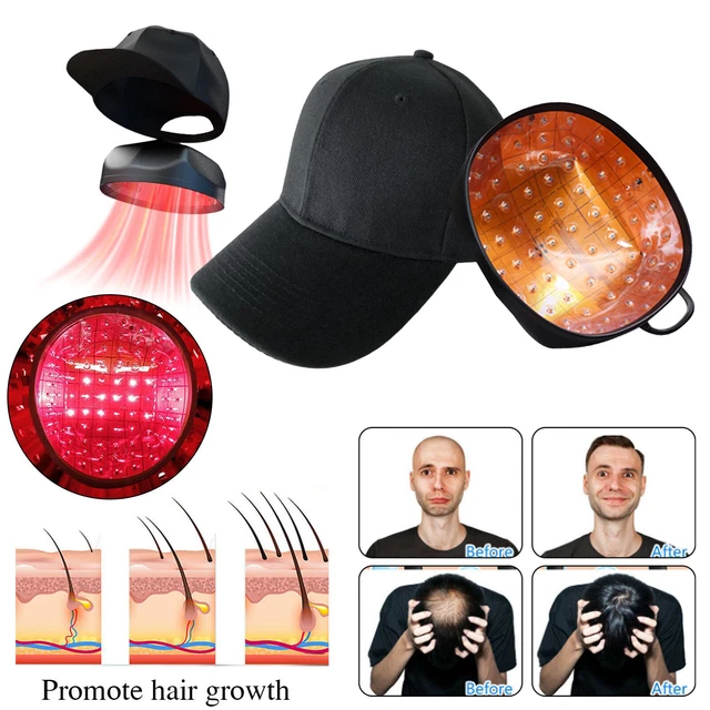 94 Diodes Laser LED Hair Growth Cap Hair Loss Treatment Device Regrowth Therapy 94 Diodes Laser LED Hair Growth Cap Hair Loss Treatment Device Regrowth Therapy