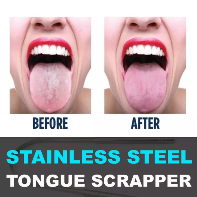 Stainless Steel Metal Tongue Scraper Cleaner For Bad Breath Oral Health Cleaning