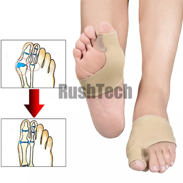 2Pcs Big Toe Bunion Corrector Splint Straightener Foot Pain Relief Hallux Valgus