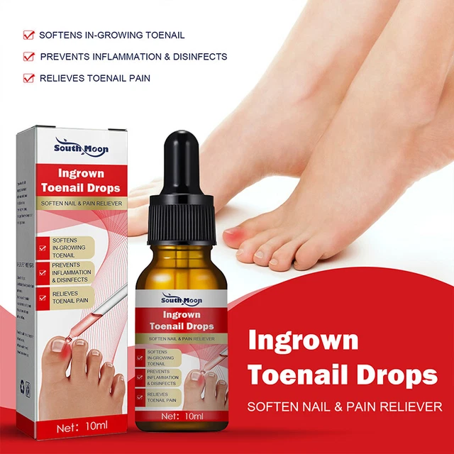 10/30 ml tratamiento de uñas encarnadas suero corrección de uñas recuperación aceite alivio del dolor
