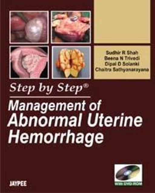 STEP BY STEP: Management of Abnormal Uterine Hemorrhage by Dipal D ...