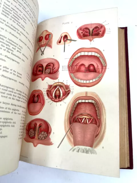 1899 Diseases Ear Nose Throat Seth Scott Bishop antique medical book oddity
