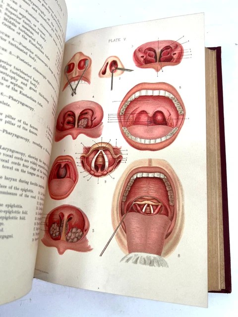 1899 Diseases Ear Nose Throat Seth Scott Bishop antique medical book oddity 1899 Diseases Ear Nose Throat Seth Scott Bishop antique medical book oddity