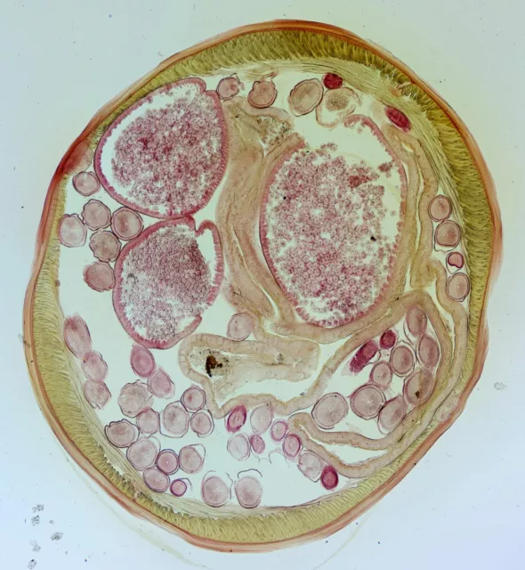 Antique microscope slide by W.Watson. "Section of Ascaris".