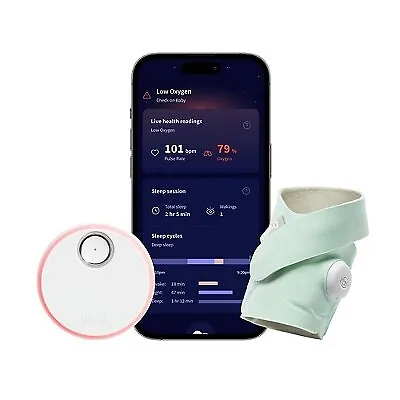 Owlet Dream Sock - FDA-Cleared Smart Baby Monitor with Live Health Readings and