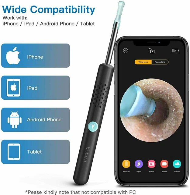 BEBIRD EAR WAX Removal Ear Camera Cleaning Endoscope Spoon Mini Ear ...