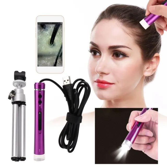 500X HD USB Skin Care Detector Digital Scalp Hair Microscope Analyzer Set YL
