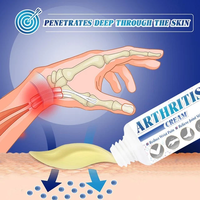 ARTHRITIS OSTEOARTHRITIS RHEUMATOID Tenosynovitis Gout Gel Cream Pain