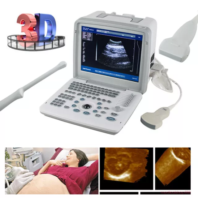 3D Full Digital Ultrasound Scanner Machine +Convex /Linear/Transvaginal Probe