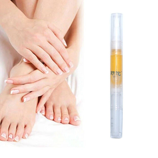 Best Home Remedy Toenail Fungus | Natural Remedy for Nail Fungus