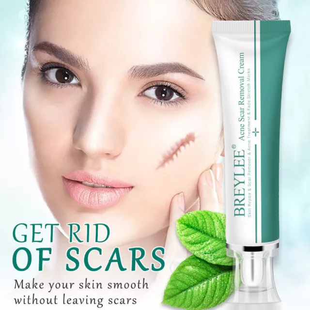 Best Scar removal Cream Skin Care for Scars Reduce Surgery Acne Stretch Mark AU`