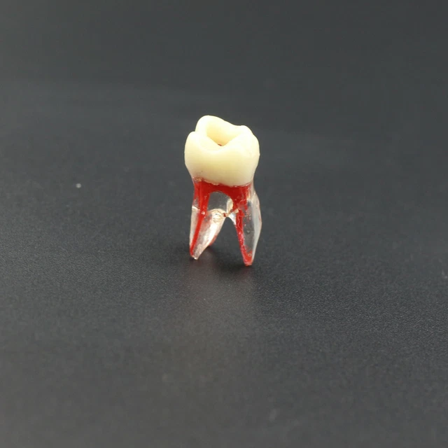DENTAL ENDODONTIC RCT Practice Teeth Pulp Cavity Model 16 UR6 First