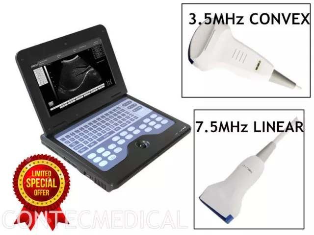 Full Digital-Ultraschall-Scanner-Maschine CMS600P2+3,5 Convex 7.5 Linear 2 Sonde