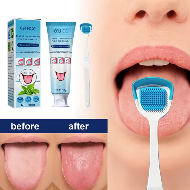 Eliminar mal aliento lengua limpieza cuidado bucal cepillo fresco limpio Q