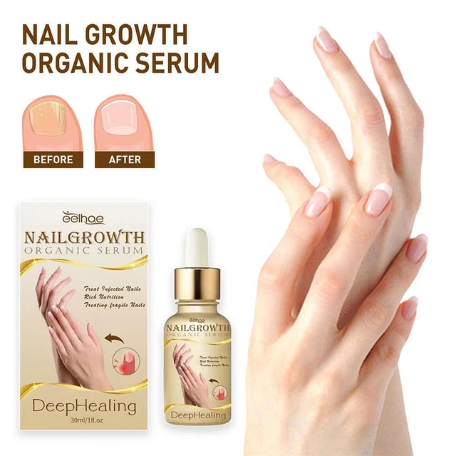 Suero de curación profunda para crecimiento de uñas, suero para crecimiento de uñas VENTA