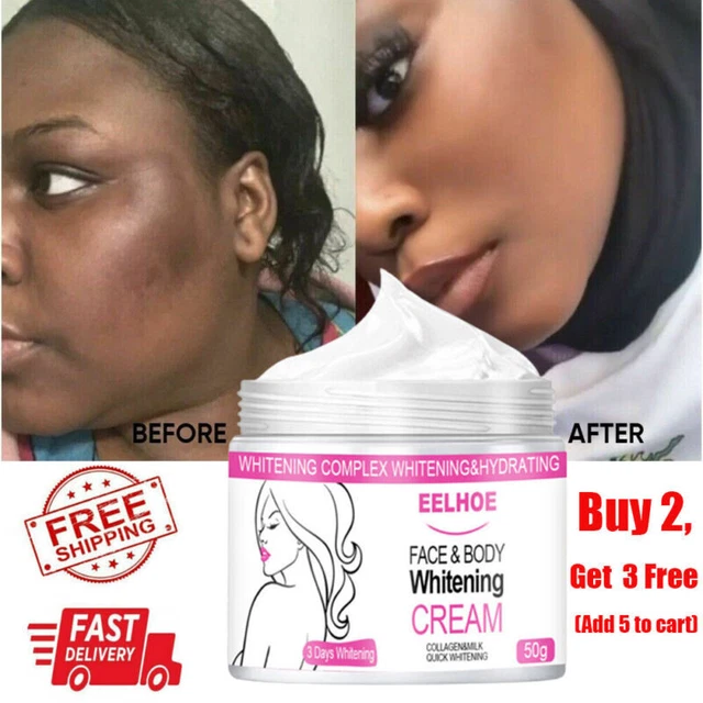 3 DAYS DARK Skin Permanent Bleaching Cream Whitening Brightening