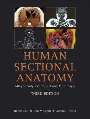 HUMAN SECTIONAL ANATOMY: Atlas of Body Sections, CT and MRI Images ...