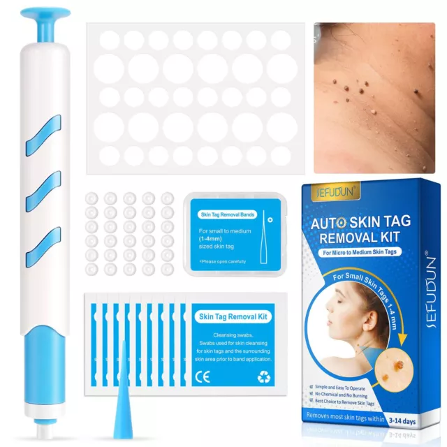 1 set Skin Tags Remover Pen,Auto Skin Tags Remover Kit for 1-4mm Skin Tags/Warts