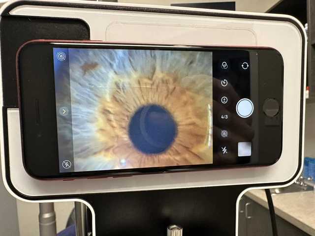 Phonto Imaging Optic System Apple & Android Phone Wireless Slit Lamp Adaptor