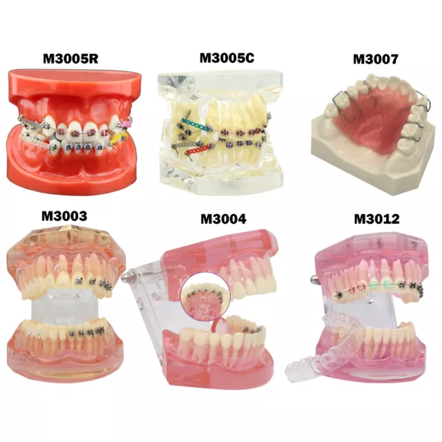 Dental Orthodontic Teeth Models with Metal Ceramic Brackets Lingual Braces Tube