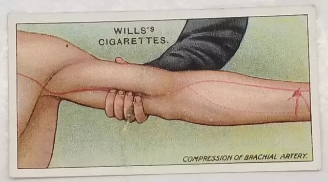 Wills's First Aid COMPRESSION OF ARTERY Medical Vintage Cigarette Card #12