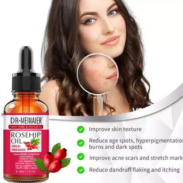 Rosehip Essential Oil Natural Pure Oil For Face Anti Wrinkle 7W3Q Aging Q3B7