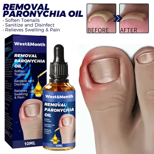 2023 Agujas del pie antiparoniquia alivio aceite reparación de uñas cuidado de la salud N ◑