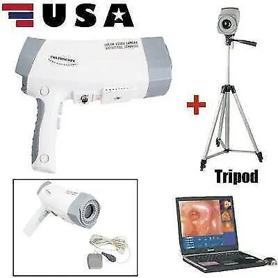 Carejoy  Digital High accuracy Portable 480000 Pixels Electronic Colposcope