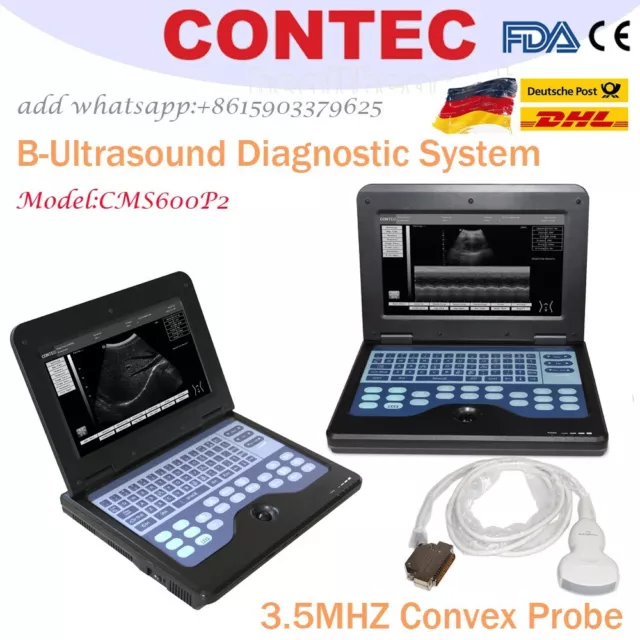 Système de diagnostic B-Ultrasound Digital B-Ultrasound Contec avec sonde convex