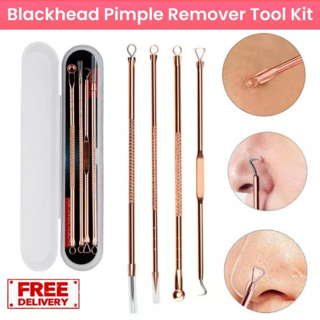 Blackhead Acne Popper Spot Pimple Comedone Whitehead Remover Extractor Face Tool