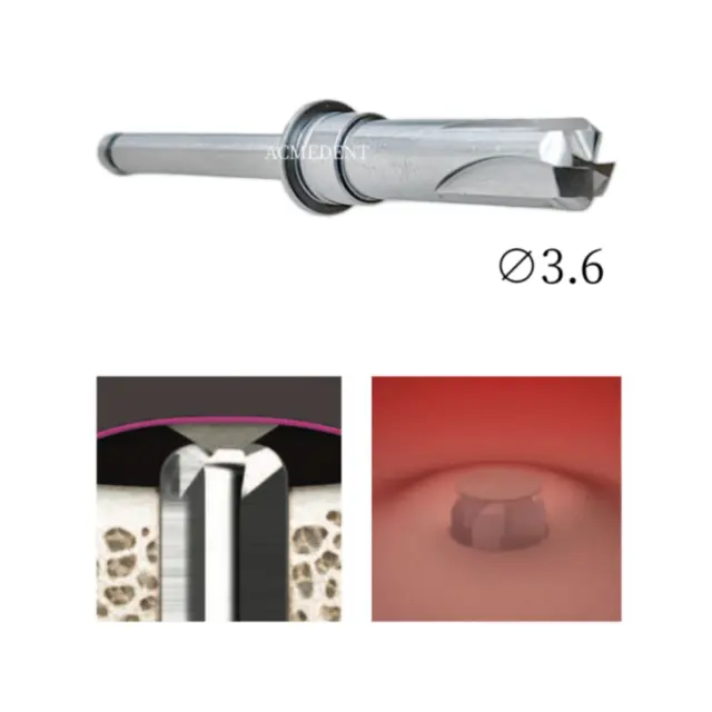 Dental Membrane Lift Drills ∅3.6 Osstem Crestal Sinus CAS Hydraulic Water Pipe