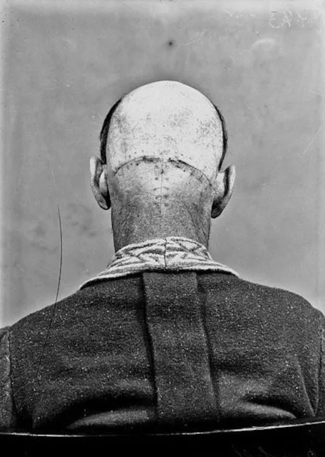 Antique Civil War Medical Photo 497b Oddleys Strange & Bizarre