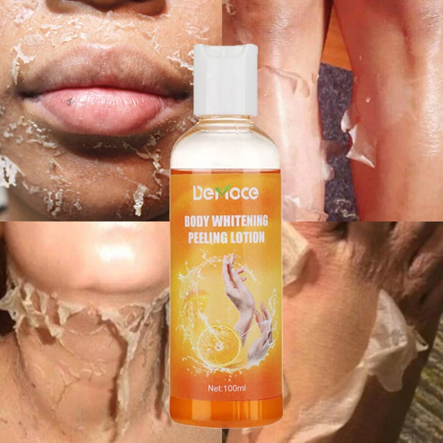 Orange Peeling Lotion crema aclaradora corporal blanqueadora de la piel ☀