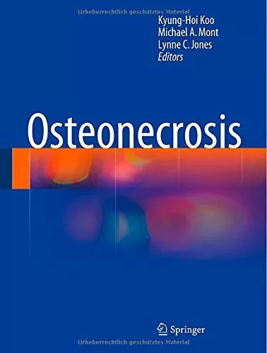 Osteonecrosis.by Koo, Mont, Jones  New 9783642357664 Fast Free Shipping<|