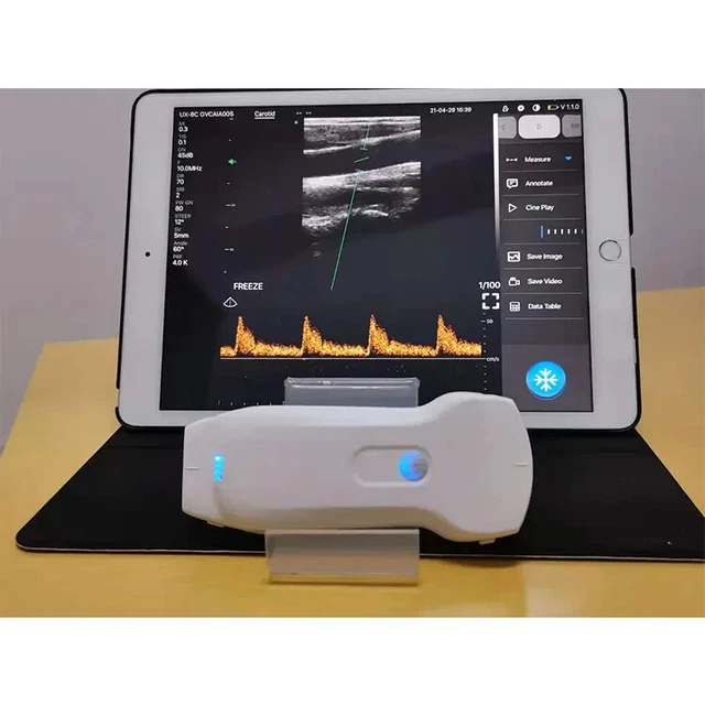 3 In 1 Linear Convex Double Probes Smartphone USB WIFI Ultrasound Probe Portable