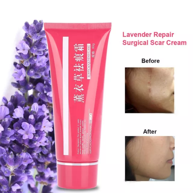 Lavender Repair Surgical Reduce Caesarean Pregnancy Repair Cream Skin Care GSA